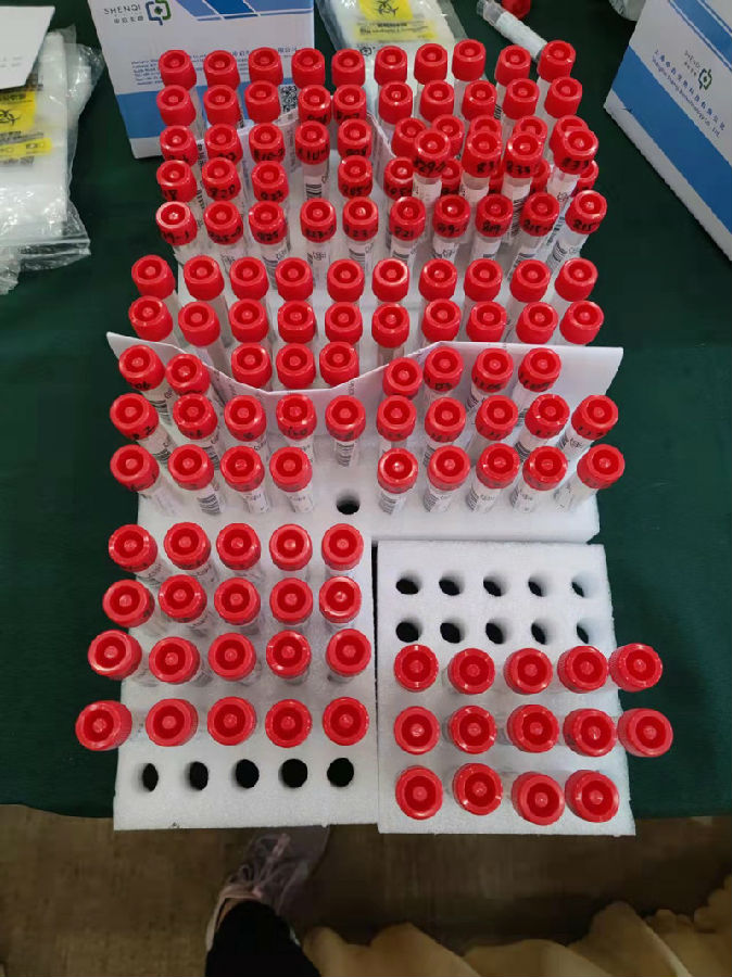 0314-49涔濅笁瀛︾ぞ涓婃搗甯傚錛氣?澶х櫧鈥濈ぞ鍛橈紝浣犳渶鍙埍錛?6 鍖誨姟浜哄憳鎶婇噰鏍風鍙綔鈥滃皬綰㈠附鈥?jpg